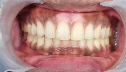 After treatment - case 2