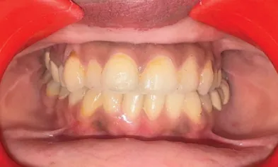 After treatment - case 3
