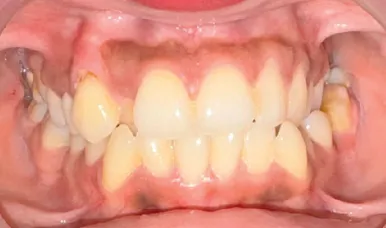 Before treatment - case 3