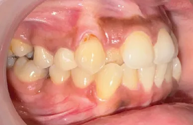 Before treatment - case5