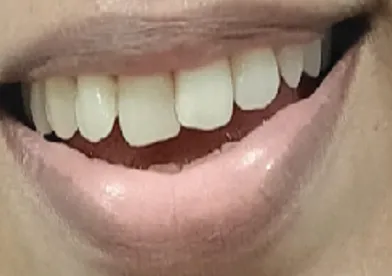 Before treatment - case7