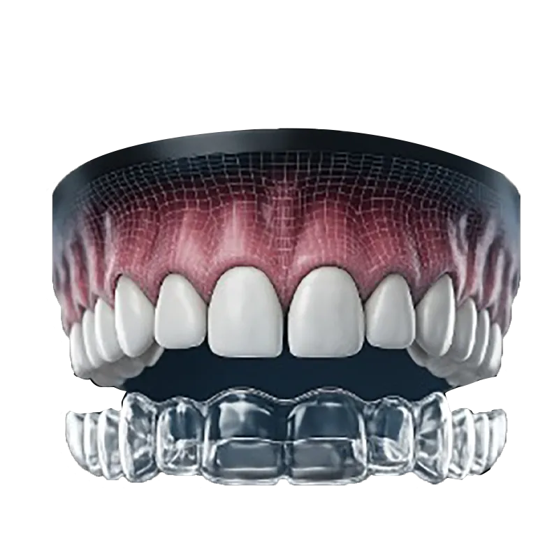 Gap Teeth