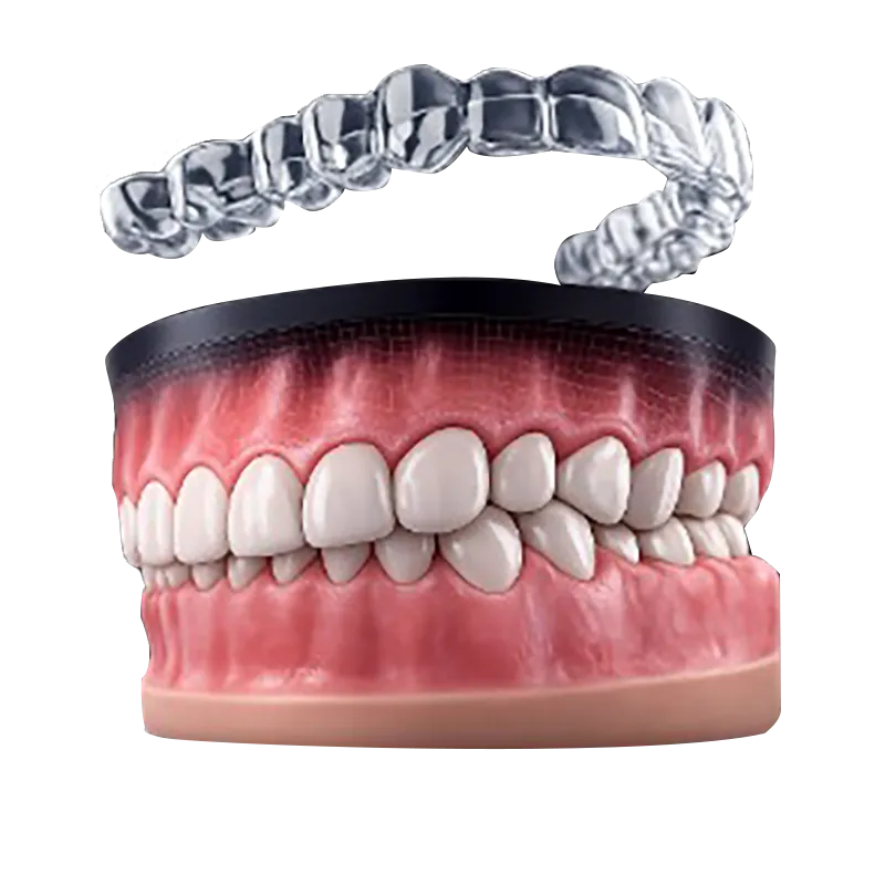 Crossbite